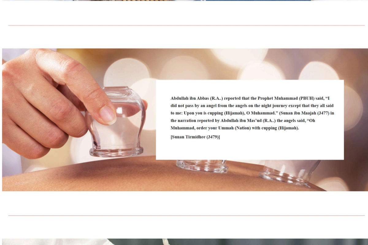 Hijamah Client Delloweb International
